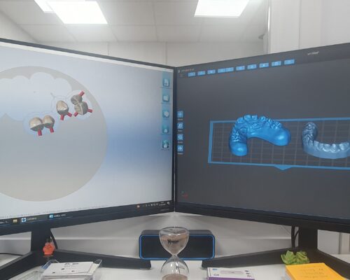 Fitcam dental
