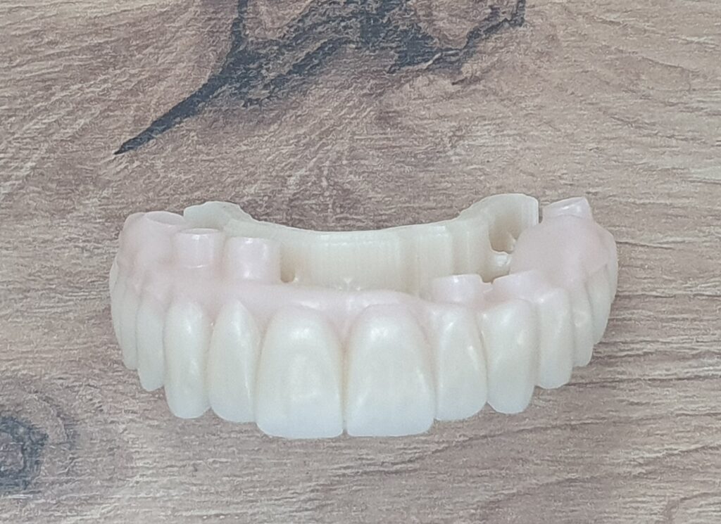 Fitcam dental