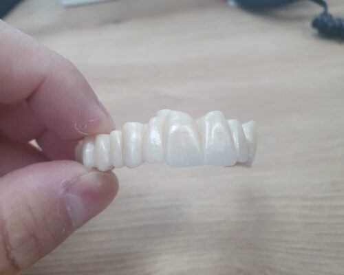 Fitcam dental